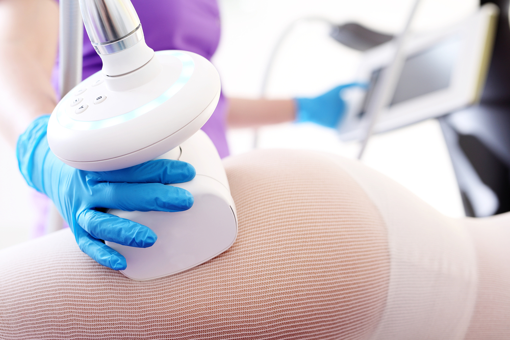 Endermologie